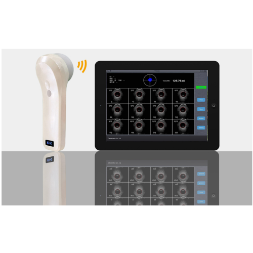 4D-Blase-Ultraschallsonde